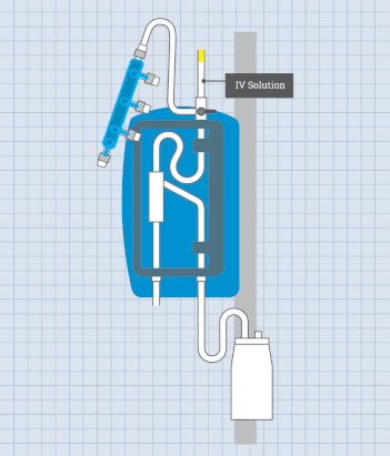 Animated Gif shows how the Clearline IV purges air from an IV.